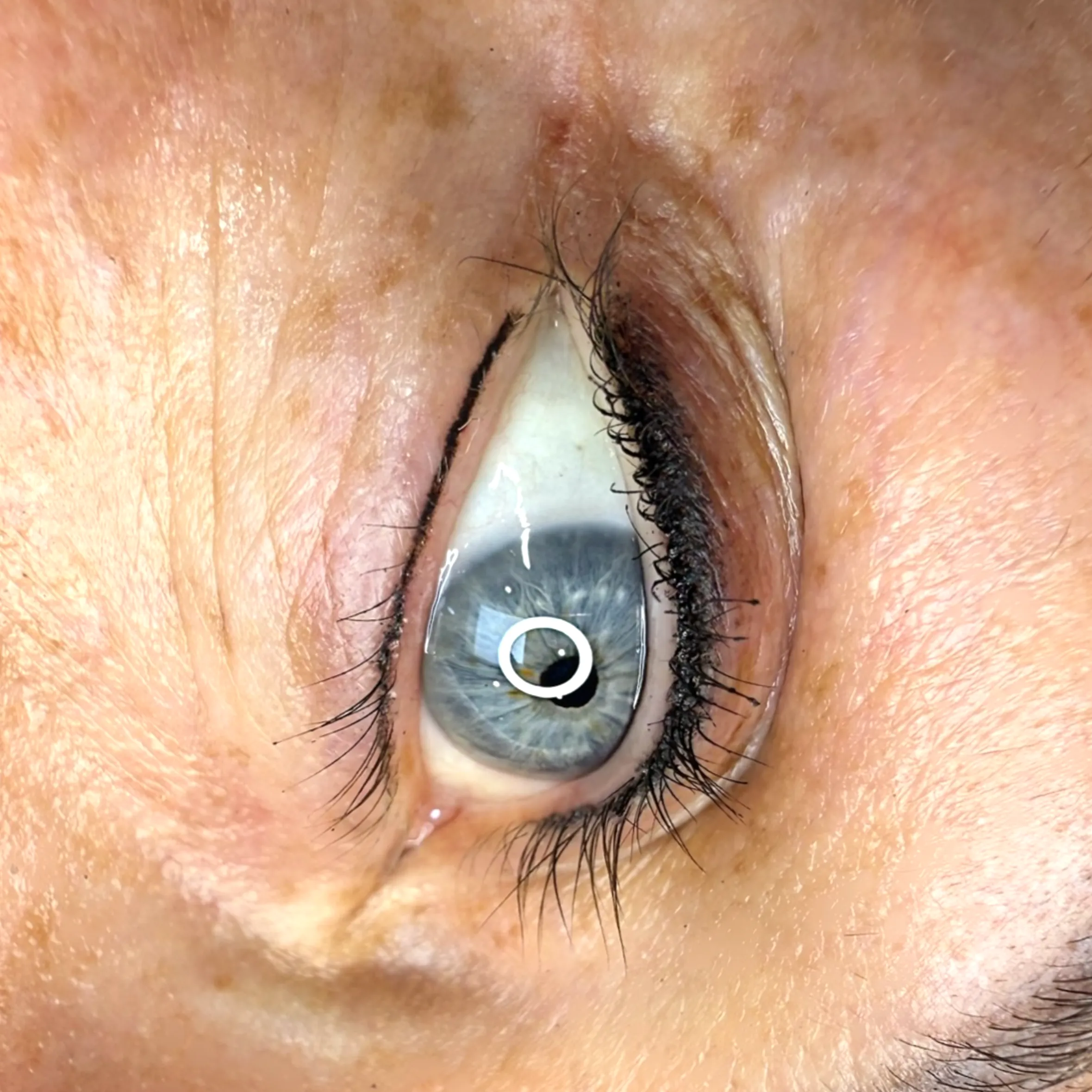 safe eye drops after eyeliner tattoo