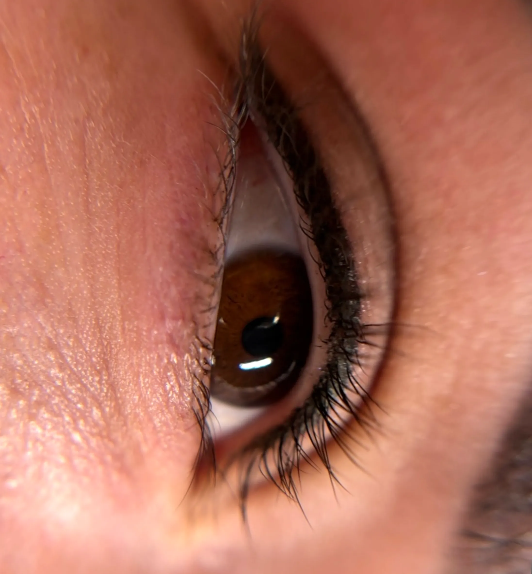 how to stop eyeliner tattoo itch