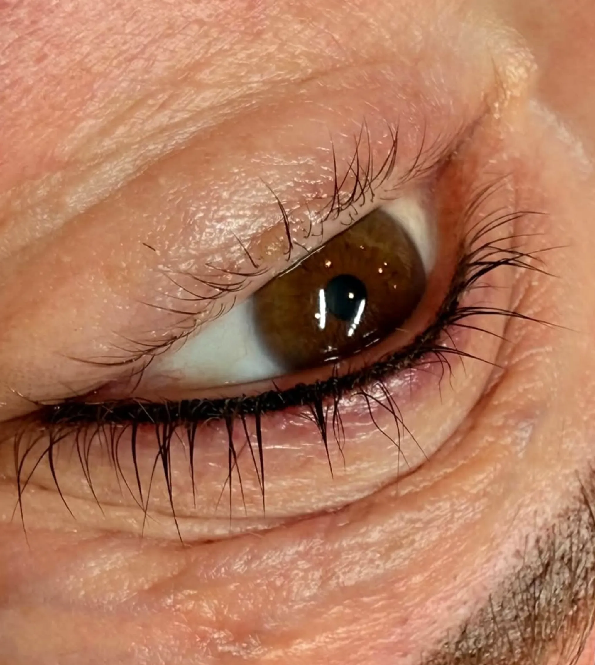 eyeliner tattoo allergic reaction signs
