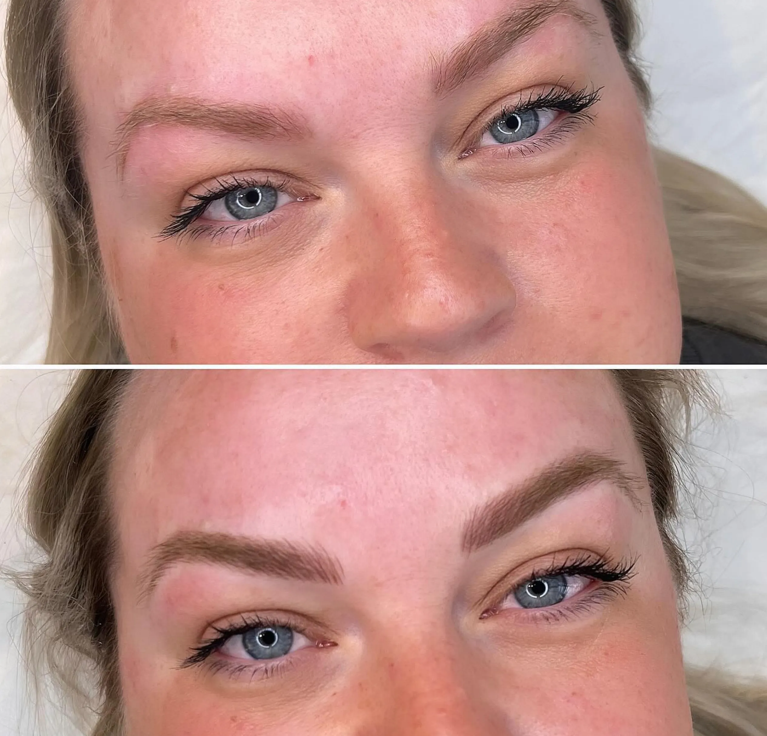 patchy microblading healing